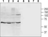 WB analysis of rat brain membrane (lanes 1 and 5), mouse brain membrane (lanes 2 and 6), C6 cell (lanes 3 and 7), and SH-SY5Y cell (lanes 4 and 8) lysates using GTX16929 P2X4 antibody preincubated with or without immunogen peptide. Dilution : 1:200 WB analysis of rat brain membrane (lanes 1 and 5), mouse brain membrane (lanes 2 and 6), C6 cell (lanes 3 and 7), and SH-SY5Y cell (lanes 4 and 8) lysates using GTX16929 P2X4 antibody preincubated with or without immunogen peptide. Dilution : 1:200