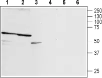 WB analysis of rat brain membrane (lanes 1 and 4), mouse brain membrane (lanes 2 and 5), and PC12 cells (lanes 3 and 6) lysates using GTX16933 P2X2 antibody preincubated with or without immunogen peptide. Dilution : 1:200 WB analysis of rat brain membrane (lanes 1 and 4), mouse brain membrane (lanes 2 and 5), and PC12 cells (lanes 3 and 6) lysates using GTX16933 P2X2 antibody preincubated with or without immunogen peptide. Dilution : 1:200