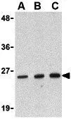 WB analysis of RAW264.7 cell lysate using GTX16979 DEDD2 antibody. Working concentration : (A) 0.5,(B) 1,and (C) 2 ug/ml
