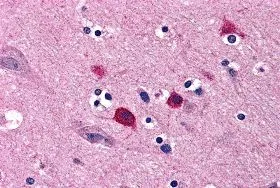 IHC-P analysis of human brain tissue using GTX16981 Bok antibody. Working concentration : 5 microg/ml IHC-P analysis of human brain tissue using GTX16981 Bok antibody. Working concentration : 5 microg/ml