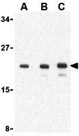 WB analysis of 293 cell lysate using GTX16982 AES antibody. Working concentration : (A) 1, (B) 2, and (C) 4 microg/ml WB analysis of 293 cell lysate using GTX16982 AES antibody. Working concentration : (A) 1, (B) 2, and (C) 4 microg/ml