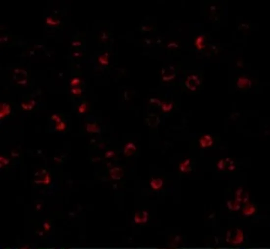 ICC/IF analysis of MCF7 cells using GTX16984 ATG7 antibody. Working concentration : 20 microg/ml