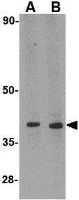 WB analysis of MDA-MB-361 cell lysate using GTX16995 DHX58 antibody. Working concentration : (A) 0.5 and (B) 1 microg/ml WB analysis of MDA-MB-361 cell lysate using GTX16995 DHX58 antibody. Working concentration : (A) 0.5 and (B) 1 microg/ml
