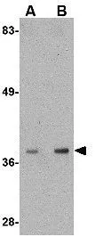 WB analysis of mouse liver tissue lysate using GTX17013 ALDH3A2 antibody. Working concentration : (A) 1 and (B) 2 ug/ml