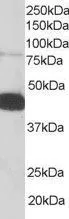 WB analysis of human PBMC lysate using GTX17020 Pleckstrin antibody, C-term. Dilution : 0.05microg/ml Loading : 35microg protein in RIPA buffer WB analysis of human PBMC lysate using GTX17020 Pleckstrin antibody, C-term. Dilution : 0.05microg/ml Loading : 35microg protein in RIPA buffer