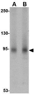 WB analysis of A-20 cell lysate using GTX17023 AAK1 antibody. Working concentration : (A) 1 and (B) 2 ug/ml