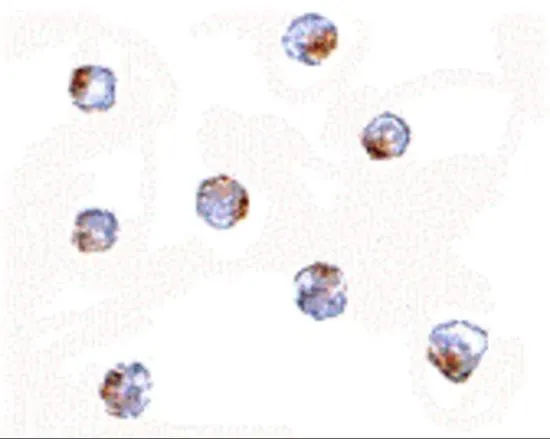 ICC/IF analysis of A-20 cells using GTX17023 AAK1 antibody. Working concentration : 5 microg/ml