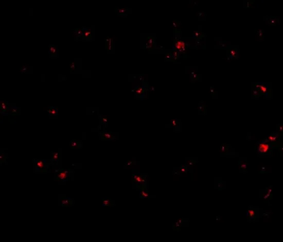 IHC-P analysis of human brain tissue using GTX17023 AAK1 antibody. Working concentration : 20 microg/ml