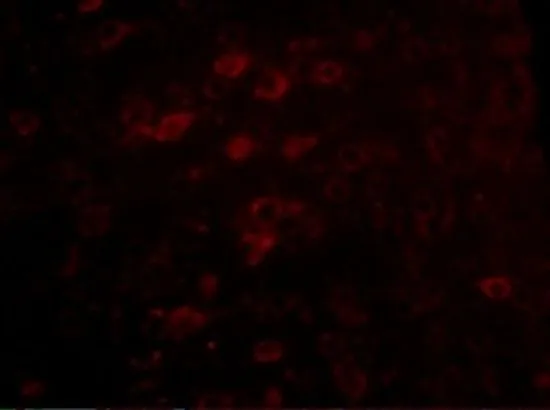 IHC-P analysis of mouse brain tissue using GTX17028 LASS6 antibody. Working concentration : 5 microg/ml