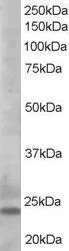 WB analysis of K562 lysate using GTX17031 Bim antibody, C-term. Dilution : 0.5microg/ml Loading : 35microg protein in RIPA buffer WB analysis of K562 lysate using GTX17031 Bim antibody, C-term. Dilution : 0.5microg/ml Loading : 35microg protein in RIPA buffer