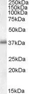 WB analysis of peripheral blood mononucleocytes lysate using GTX17032 LAT antibody, C-term. Dilution : 0.01microg/ml Loading : 35microg protein in RIPA buffer