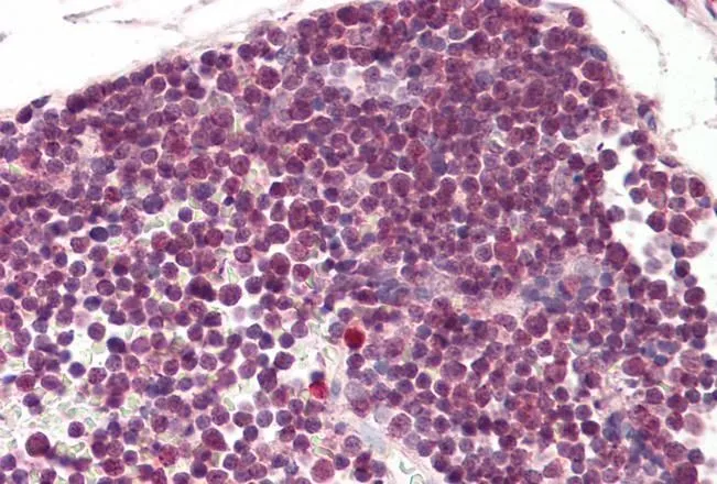 IHC-P analysis of human thymus using GTX17033 RAN antibody, N-term. Antigen retrieval : citrate buffer pH 6 Dilution : 3.75microg/ml