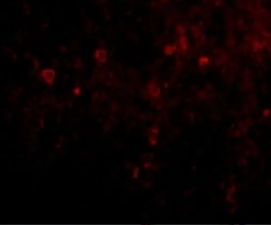 IHC-P analysis of human spleen tissue using GTX17036 EBI3 antibody. Working concentration : 20 microg/ml