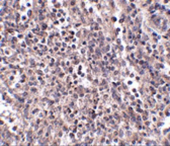 IHC-P analysis of human spleen tissue using GTX17036 EBI3 antibody. Working concentration : 2.5 microg/ml