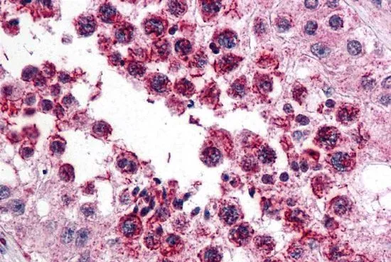 IHC-P analysis of human testis tissue using GTX17055 SLAIN2 antibody. Working concentration : 5 microg/ml IHC-P analysis of human testis tissue using GTX17055 SLAIN2 antibody. Working concentration : 5 microg/ml
