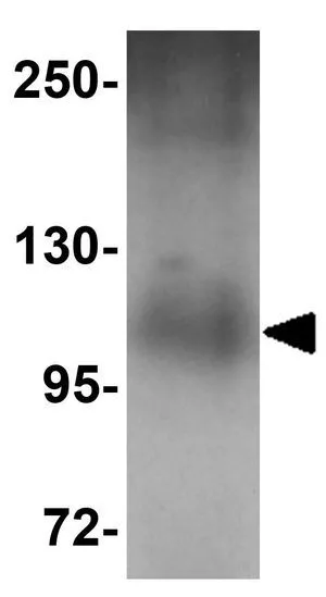 WB analysis of human lung tissue lysate using GTX17056 PLEKHM1 antibody. Working concentration : 1 microg/ml