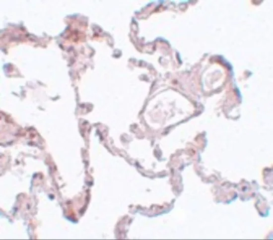 IHC-P analysis of human lung tissue using GTX17056 PLEKHM1 antibody. Working concentration : 5 microg/ml