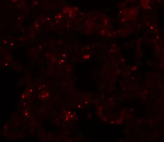 IHC-P analysis of human lung tissue using GTX17056 PLEKHM1 antibody. Working concentration : 20 microg/ml