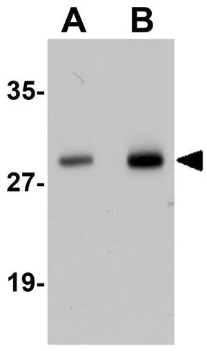 WB analysis of human lung tissue lysate using GTX17057 Synaptogyrin 2 antibody. Working concentration : (A) 1 and (B) 2 microg/ml WB analysis of human lung tissue lysate using GTX17057 Synaptogyrin 2 antibody. Working concentration : (A) 1 and (B) 2 microg/ml