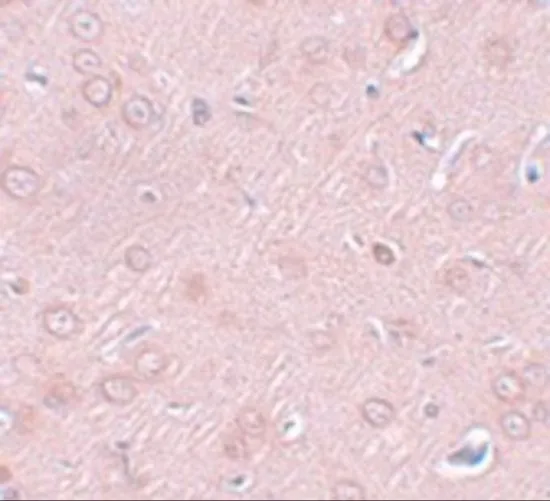 IHC-P analysis of rat brain tissue using GTX17057 Synaptogyrin 2 antibody. Working concentration : 2.5 microg/ml