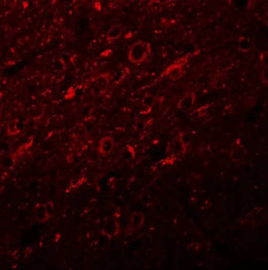 IHC-P analysis of rat brain tissue using GTX17057 Synaptogyrin 2 antibody. Working concentration : 20 microg/ml