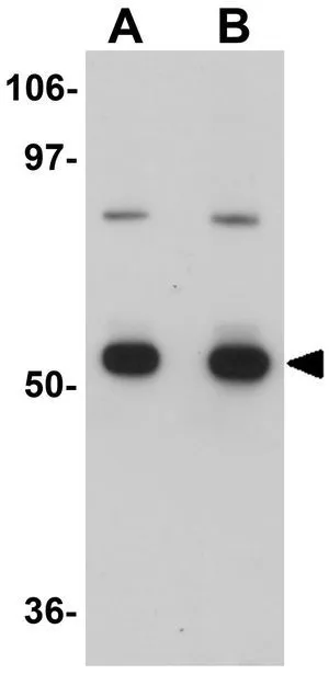 WB analysis of K562 cell lysate using GTX17066 CDC23 antibody. Working concentration : (A) 1 and (B) 2 ug/ml