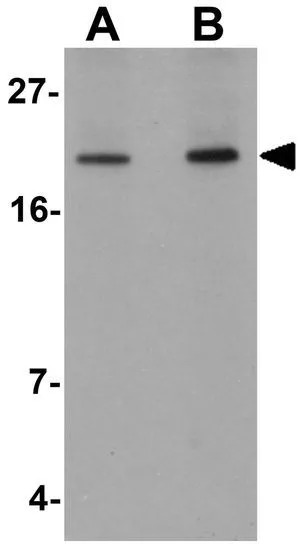 WB analysis of mouse heart tissue lysate using GTX17067 Apc10 antibody. Working concentration : (A) 1 and (B) 2 microg/ml WB analysis of mouse heart tissue lysate using GTX17067 Apc10 antibody. Working concentration : (A) 1 and (B) 2 microg/ml
