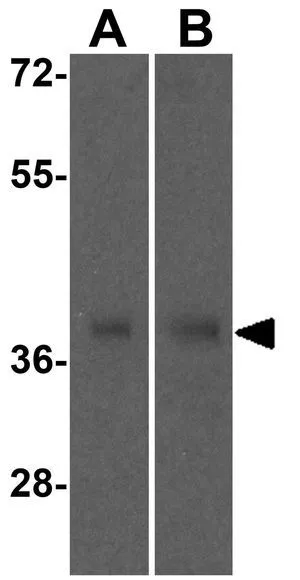 WB analysis of (A) human and (B) mouse liver tissue lysate using GTX17074 SIRT4 antibody. Working concentration : 0.5 microg/ml WB analysis of (A) human and (B) mouse liver tissue lysate using GTX17074 SIRT4 antibody. Working concentration : 0.5 microg/ml