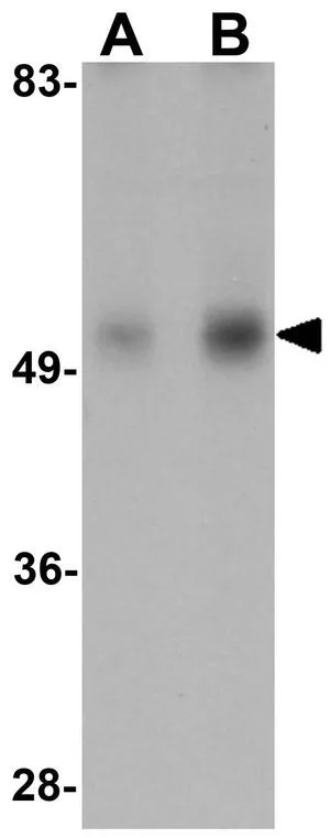 WB analysis of human heart tissue lysate using GTX17090 IDH2 antibody. Working concentration : (A) 1 and (B) 2 microg/ml WB analysis of human heart tissue lysate using GTX17090 IDH2 antibody. Working concentration : (A) 1 and (B) 2 microg/ml