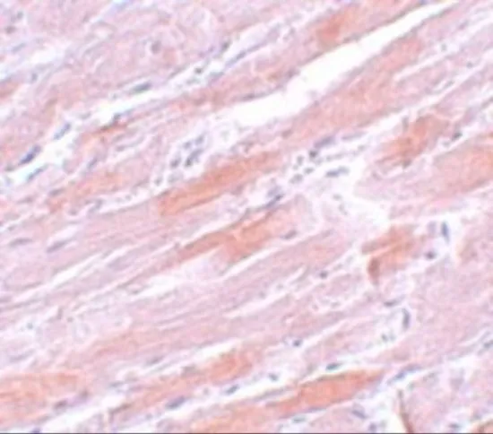 IHC-P analysis of mouse heart tissue using GTX17090 IDH2 antibody. Working concentration : 5 microg/ml