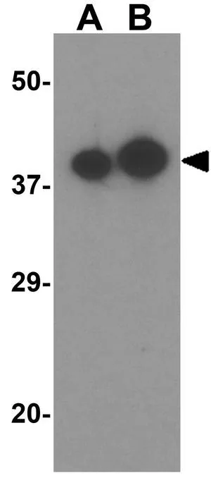 WB analysis of human testis tissue lysate using GTX17091 Apolipoprotein A4 antibody. Working concentration : (A) 0.5 and (B) 1 microg/ml WB analysis of human testis tissue lysate using GTX17091 Apolipoprotein A4 antibody. Working concentration : (A) 0.5 and (B) 1 microg/ml