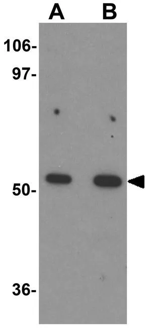 WB analysis of mouse kidney tissue lysate using GTX17092 BANP antibody. Working concentration : (A) 1 and (B) 2 microg/ml WB analysis of mouse kidney tissue lysate using GTX17092 BANP antibody. Working concentration : (A) 1 and (B) 2 microg/ml