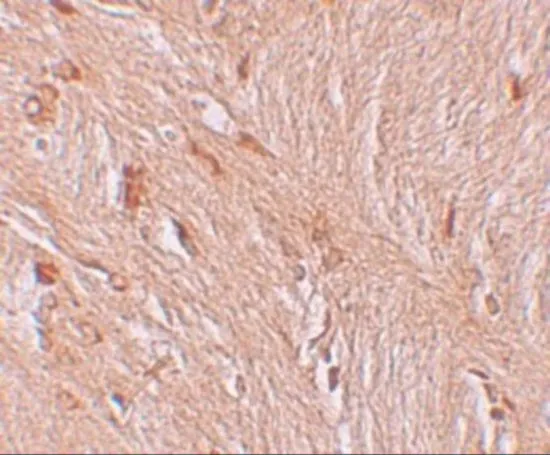 IHC-P analysis of human brain tissue using GTX17095 ZBTB3 antibody. Working concentration : 2.5 microg/ml