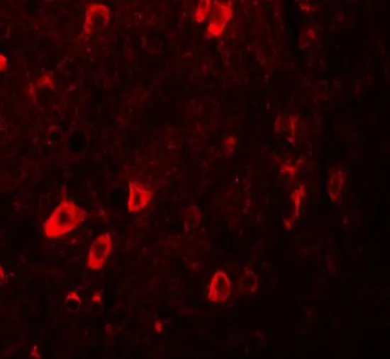 IHC-P analysis of human brain tissue using GTX17095 ZBTB3 antibody. Working concentration : 20 microg/ml