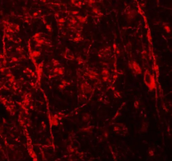 IHC-P analysis of mouse brain tissue using GTX17098 Nkx3.2 antibody. Working concentration : 20 microg/ml