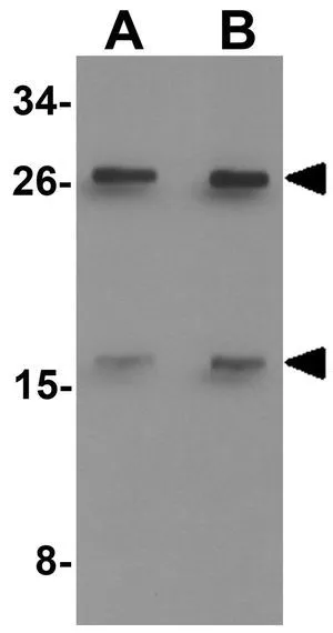 WB analysis of rat lung tissue lysate using GTX17108 CD48 antibody. Working concentration : (A) 1 and (B) 2 ug/ml