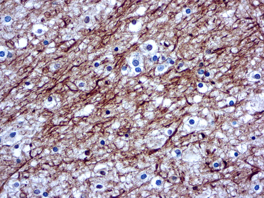 IHC Image using GTX17114 - Detection of 200kDa + 70kDa Neurofilament by IHC in Human Cerebellum