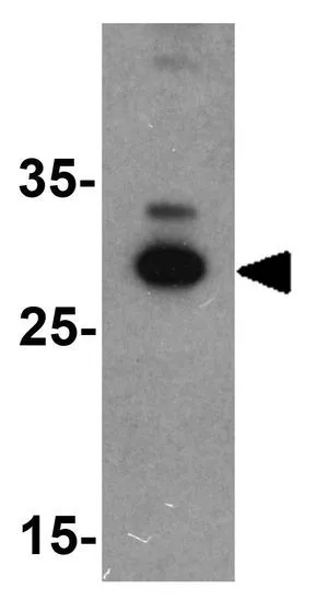 WB analysis of chicken liver tissue lysate using GTX17116 Apolipoprotein A1 antibody. Working concentration : 1 microg/ml WB analysis of chicken liver tissue lysate using GTX17116 Apolipoprotein A1 antibody. Working concentration : 1 microg/ml