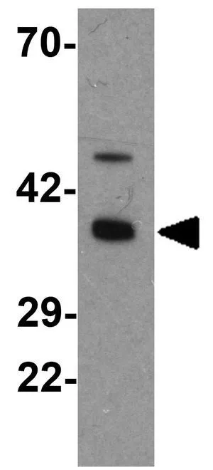 WB analysis of chicken small intestine tissue lysate using GTX17117 Apolipoprotein A4 antibody. Working concentration : 1 microg/ml