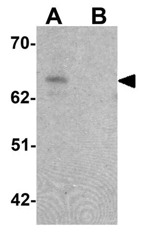WB analysis of SK-N-SH cell lysate in (A) the absence and (B) the presence of blocking peptide using GTX17161 ZGPAT antibody. Working concentration : 1 microg/ml WB analysis of SK-N-SH cell lysate in (A) the absence and (B) the presence of blocking peptide using GTX17161 ZGPAT antibody. Working concentration : 1 microg/ml