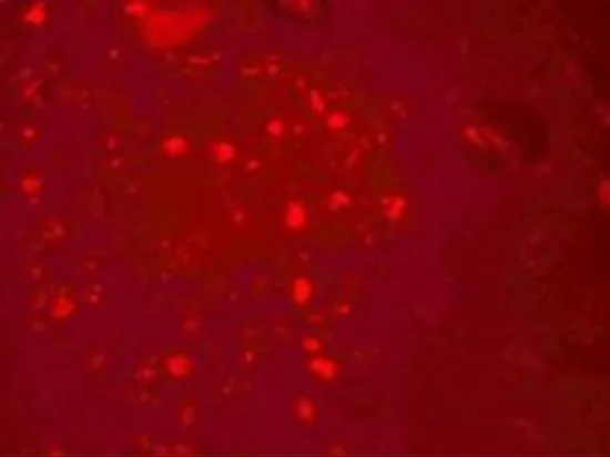 IHC-P analysis of human brain tissue using GTX17161 ZGPAT antibody. Working concentration : 20 microg/ml