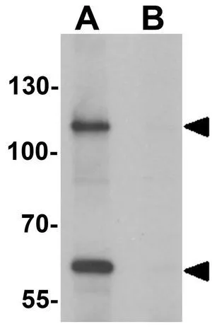 WB analysis of rat brain tissue lysate in (A) the absence and (B) the presence of blocking peptide using GTX17162 SIK3 antibody. Working concentration : 1 microg/ml WB analysis of rat brain tissue lysate in (A) the absence and (B) the presence of blocking peptide using GTX17162 SIK3 antibody. Working concentration : 1 microg/ml