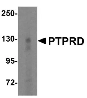 Western blot analysis of PTPRD in HeLa cell lysate with PTPRD antibody at 1 ug/mL.