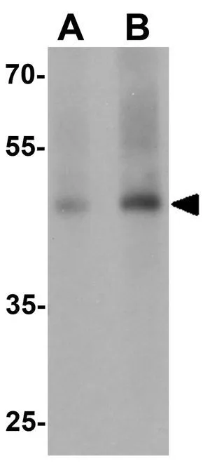 WB analysis of rat lung tissue lysate using GTX17181 GDF1 antibody. Working concentration : (A) 1 and (B) 2 microg/ml WB analysis of rat lung tissue lysate using GTX17181 GDF1 antibody. Working concentration : (A) 1 and (B) 2 microg/ml