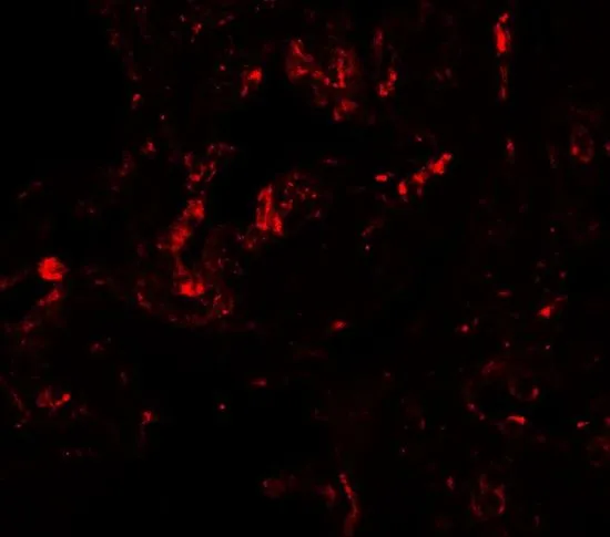 IHC-P analysis of human lung tissue using GTX17181 GDF1 antibody. Working concentration : 20 microg/ml