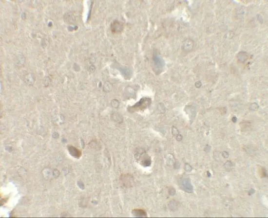 IHC-P analysis of rat brain tissue using GTX17201 MIP1 beta antibody. Working concentration : 2.5 ug/ml