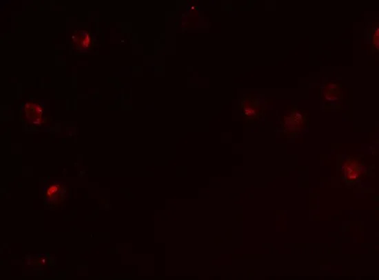 ICC/IF analysis of Jurkat cells using GTX17209 CD160 antibody. Working concentration : 5 microg/ml