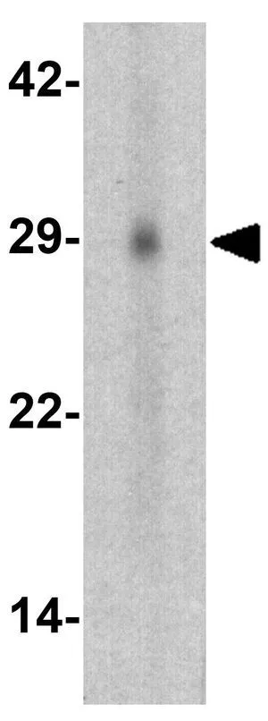 WB analysis of human small intestine tissue lysate using GTX17212 GLIPR1 antibody. Working concentration : 1 microg/ml WB analysis of human small intestine tissue lysate using GTX17212 GLIPR1 antibody. Working concentration : 1 microg/ml