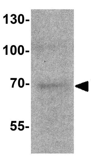 WB analysis of 293 cell lysate using GTX17215 TRF2 antibody. Working concentration : 1 microg/ml WB analysis of 293 cell lysate using GTX17215 TRF2 antibody. Working concentration : 1 microg/ml