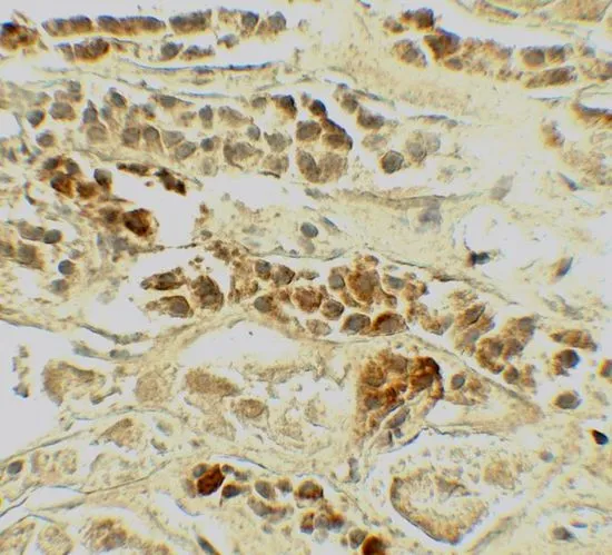 IHC-P analysis of human kidney tissue using GTX17215 TRF2 antibody. Working concentration : 5 microg/ml